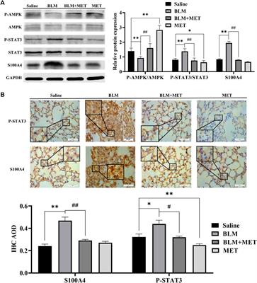 Metformin attenuates fibroblast activation during pulmonary fibrosis by targeting S100A4 via AMPK-STAT3 axis 